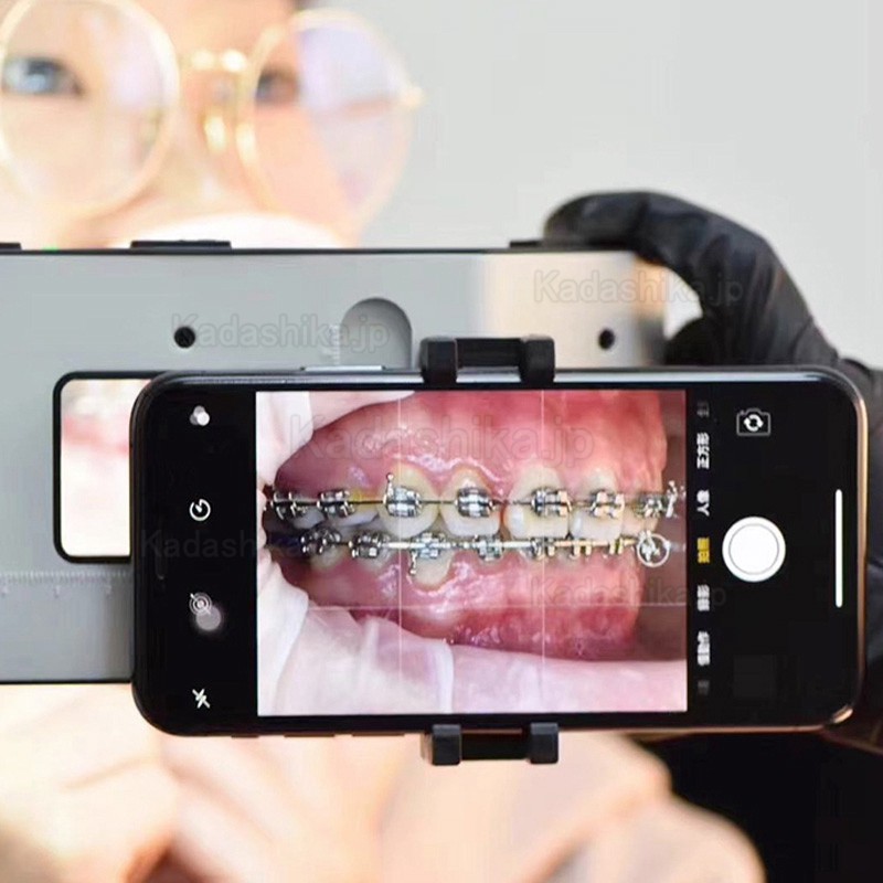 ポータブル歯科写真撮影用補助光 携帯電話フラッシュライト 歯科医向け口腔LEDフィルライト